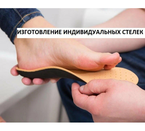 Изготовление индивидуальных стелек
